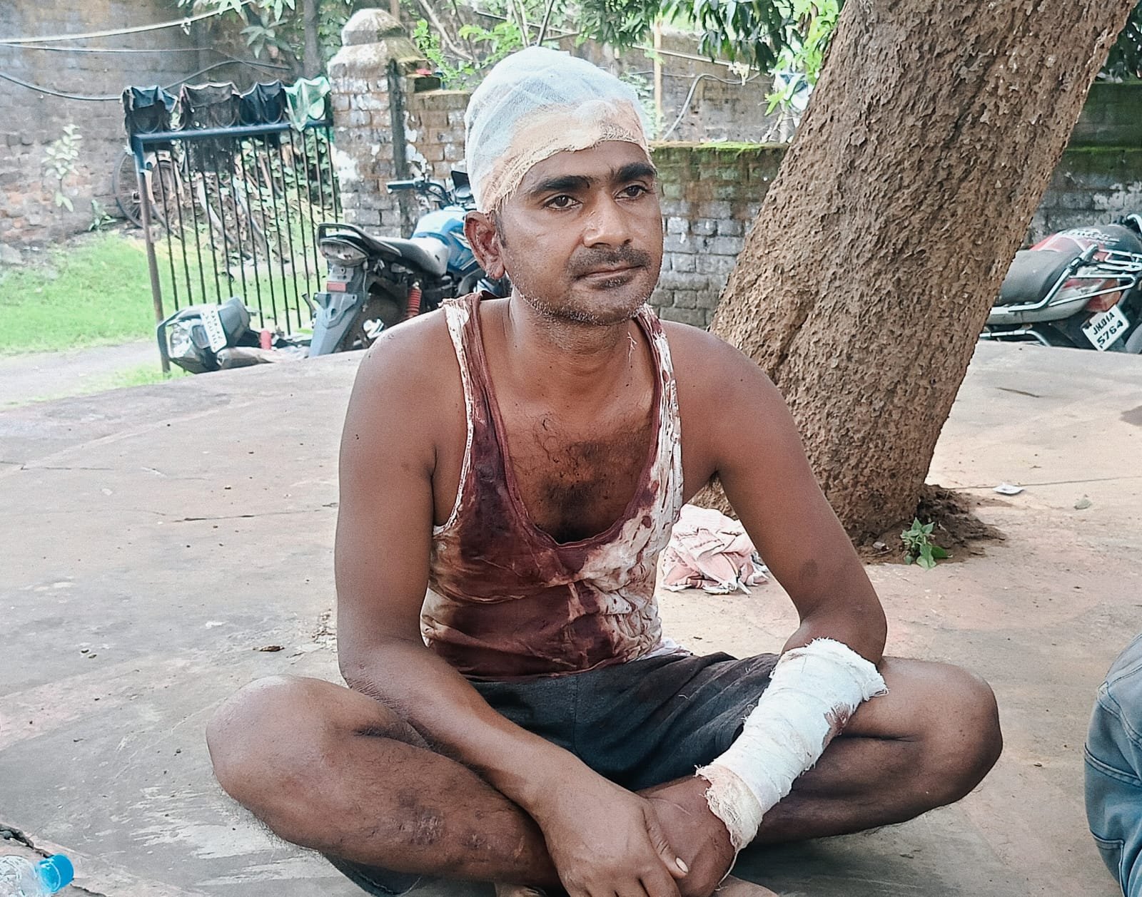 भदानीनगर के चैनगड्डा में माता पुत्र ने मिलकर चिलोही से हमला कर पति को किया गंभीर रूप से घायल