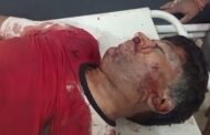 पतरातू में पेड़ से गिरने पर मजदूर की मौत