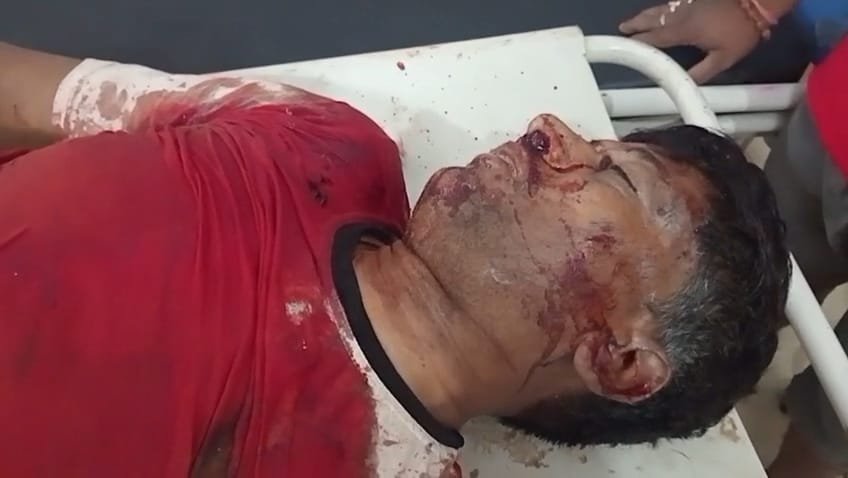 पतरातू में पेड़ से गिरने पर मजदूर की मौत