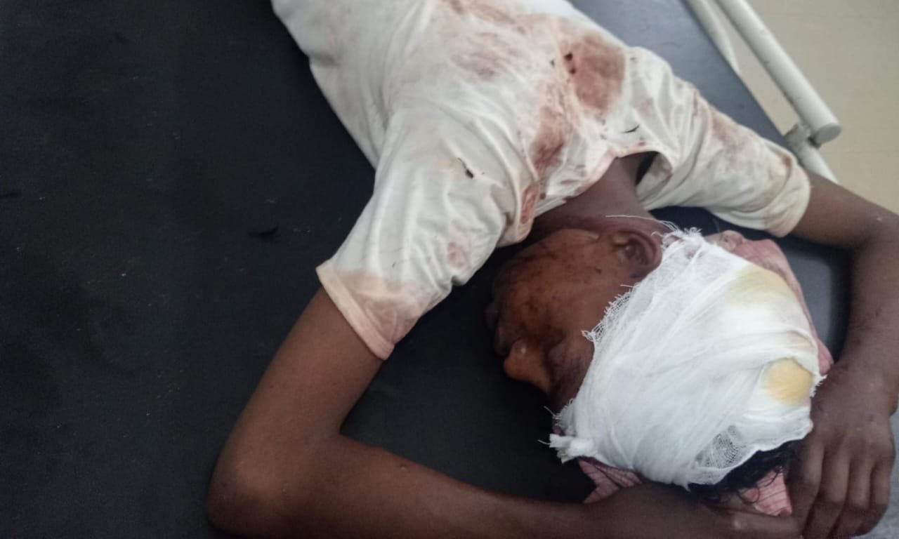 ट्रेन में सफर के दौरान युवक से मोबाइल छिनतई करने वालों ने दिया धक्का,घायल