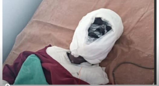 श्रीराम पावर प्लांट में दुर्घटना,दो मजदूर झूलसे,गंभीर