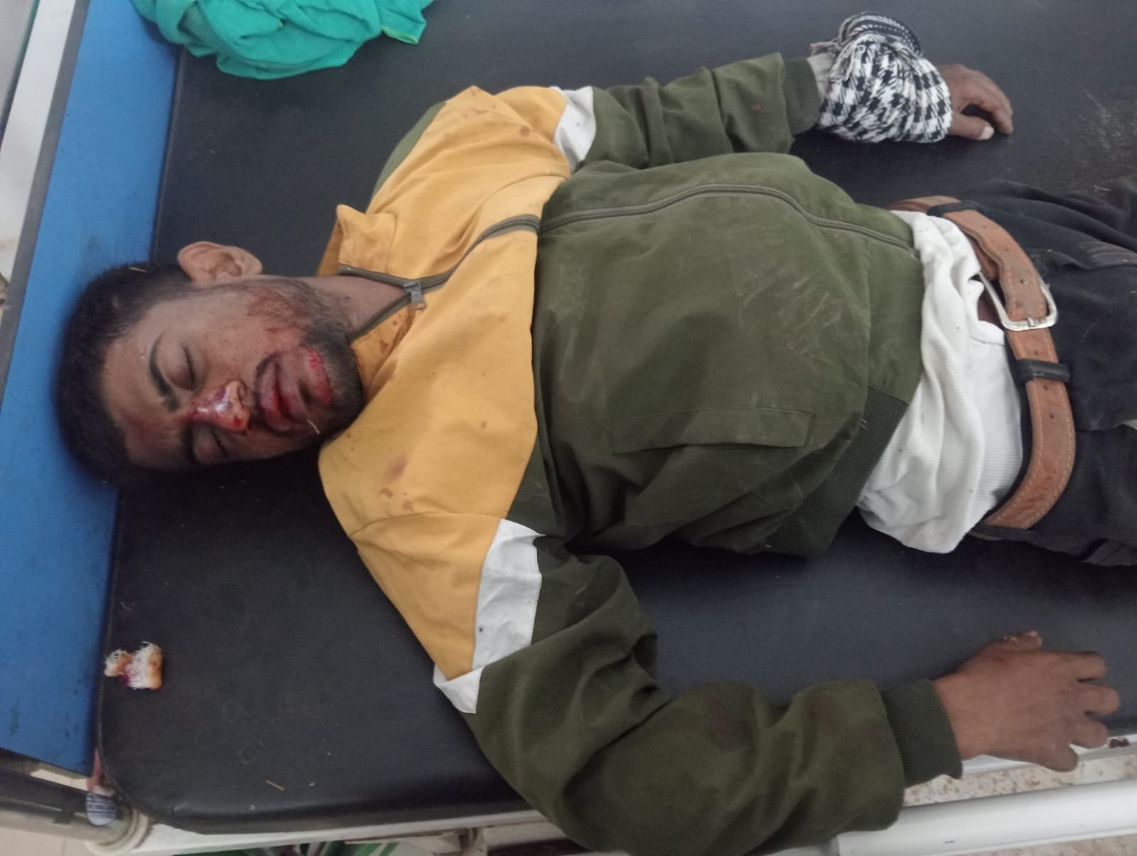 तालाटांड़ कब्रिस्तान के निकट सड़क दुर्घटना में एक युवक गंभीर रूप से हुआ घायल,रिम्स रेफर