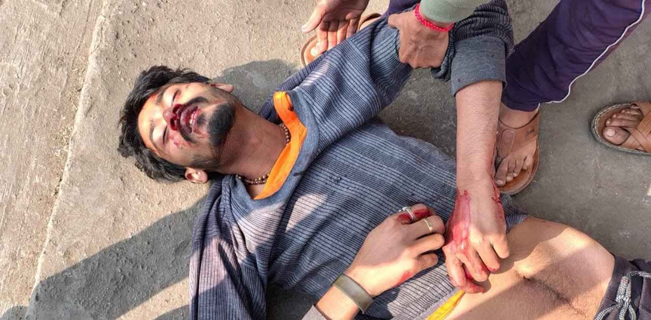 सड़क दुर्घटना में चार लोग घायल, रेफर