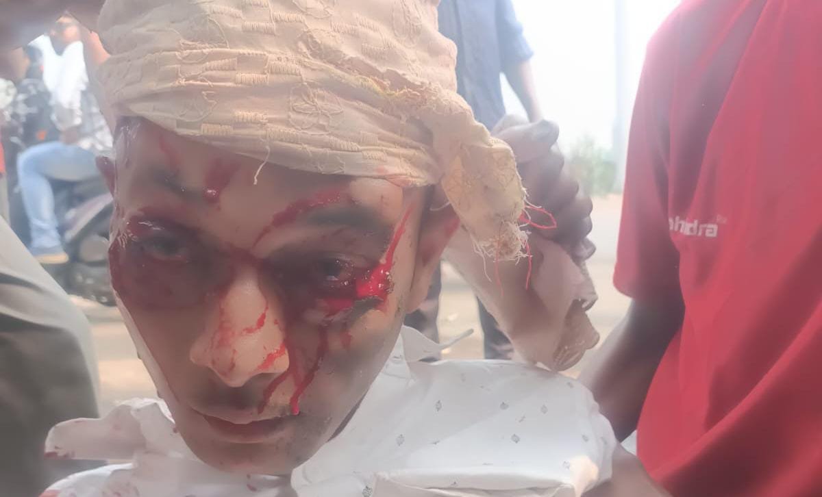 रफतार का कहर अज्ञात वाहन के टक्कर से बाइक सवार हुआ घायल, रेफर