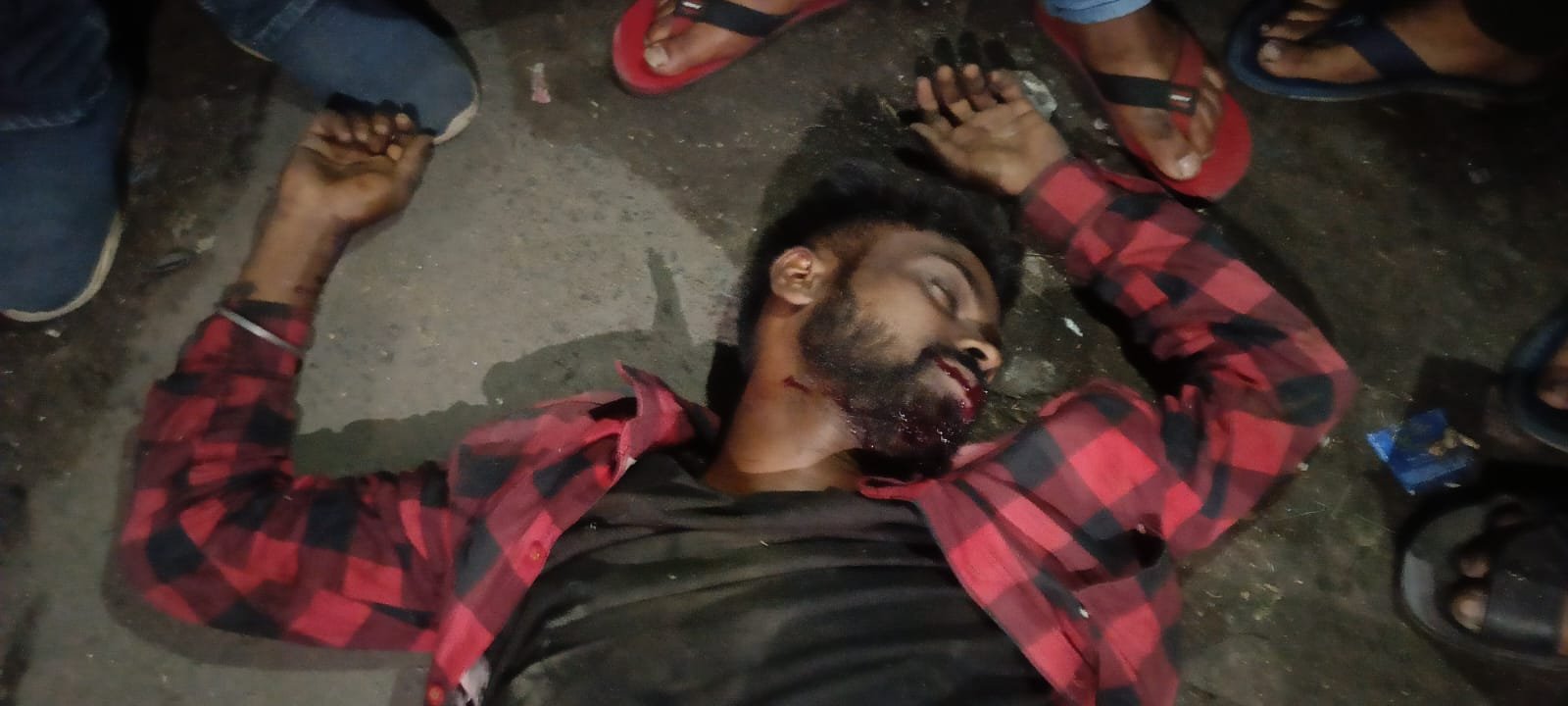 तेज रफ्तार के कारण बाइक सवार हुआ घायल