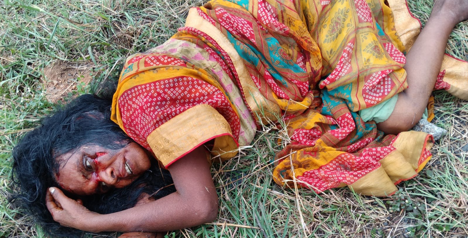 ट्रेन की चपेट में आई महिला घायल