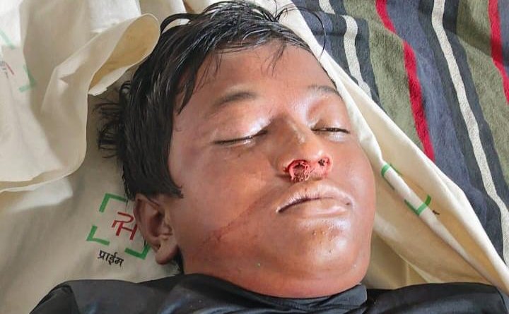 सड़क हादसे में 15 वर्षीय नवीन कुमार की मौत,परिवार में पसरा मातम