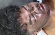 रांची जाने के दौरान घाटी में हुई दुर्घटना, युवक की मौत