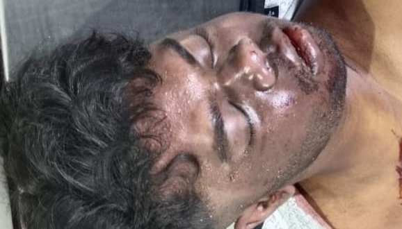 रांची जाने के दौरान घाटी में हुई दुर्घटना, युवक की मौत