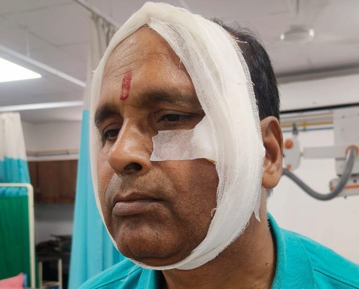 रास्ते को बंद करने का विरोध जताने पर भूमाफियाओं ने आलू-प्याज व्यवसायी को पीटकर गंभीर रूप से किया घायल,रिम्स रेफर