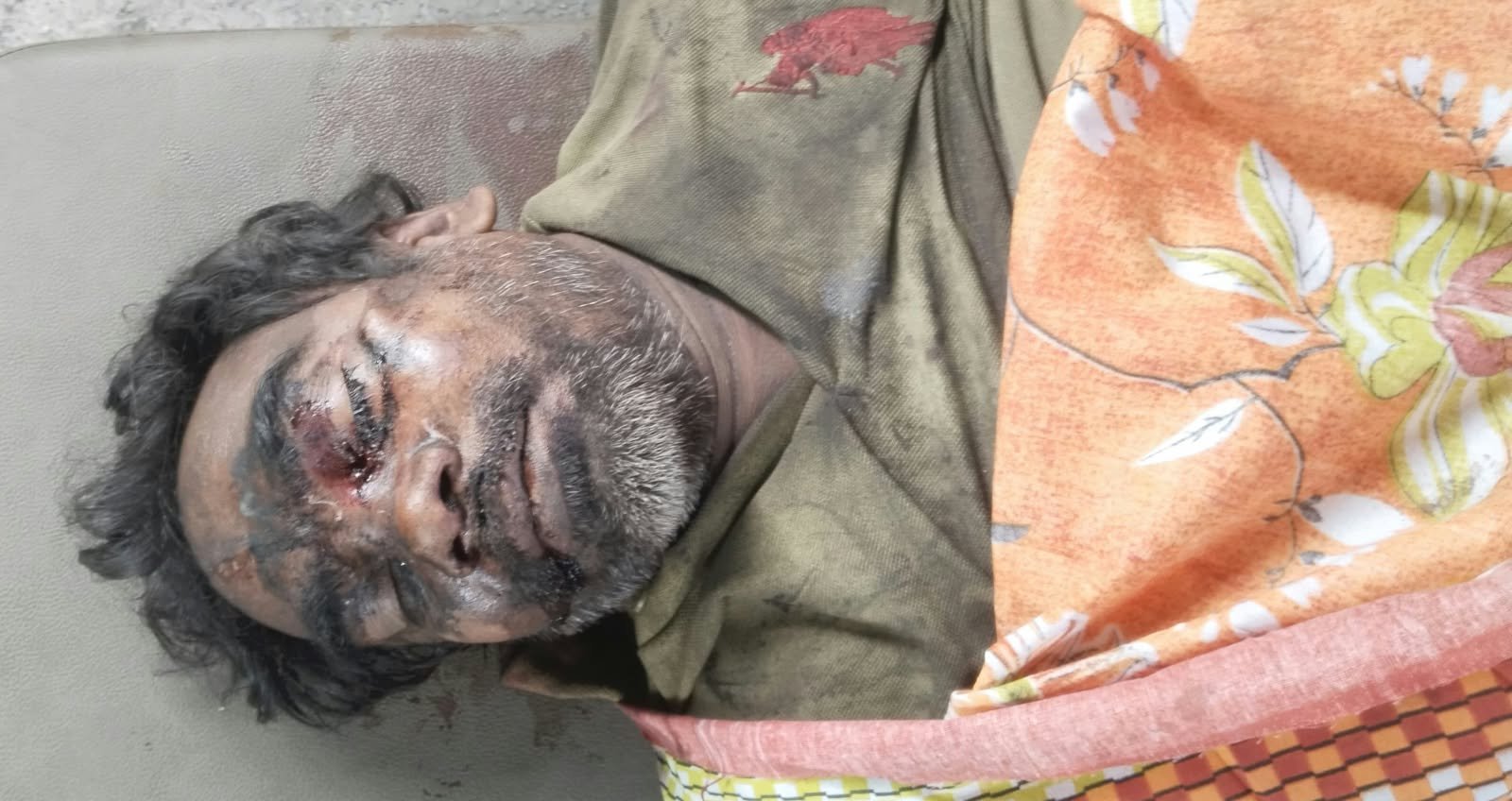 टायर ब्लास्टिंग से सीसीएल कर्मी की दर्दनाक मौत,मुआवजा को लेकर जेएलकेम ने किया आंदोलन