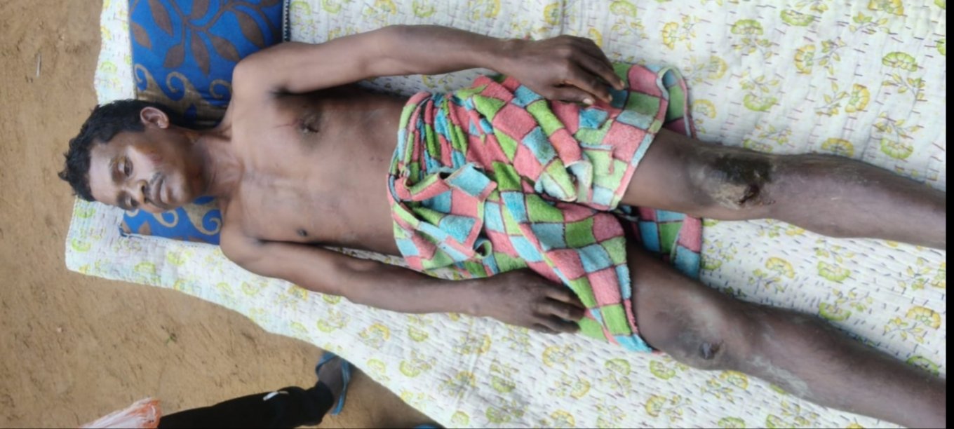 खेत में दवा डालते के समय हाथी के हमले में किसान घायल: रेफर किया गया