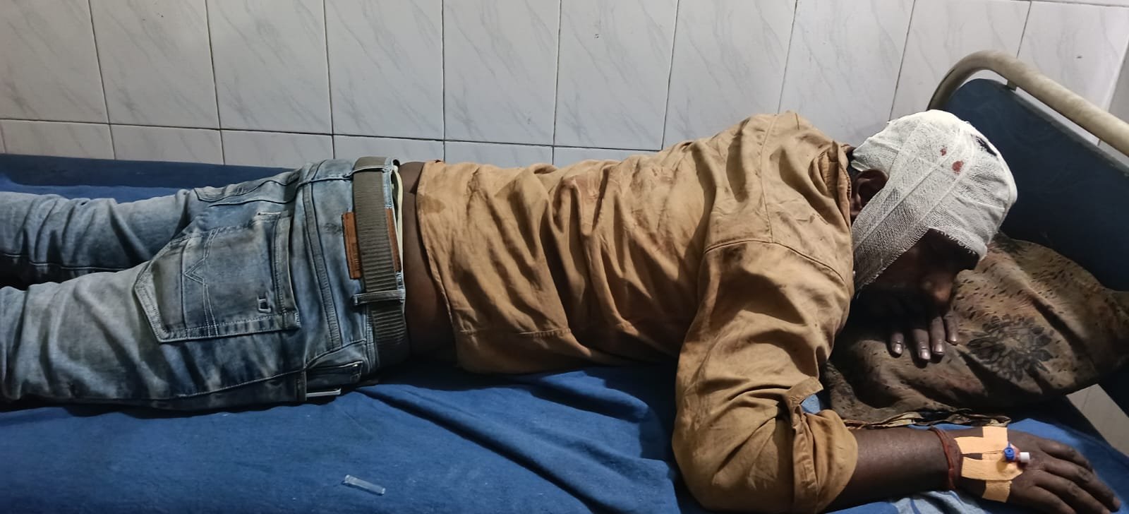 रामगढ़ के श्रीराम पावर एंड स्टील प्लांट में फिर फर्नेस ब्लास्ट,तीन कर्मचारी जले